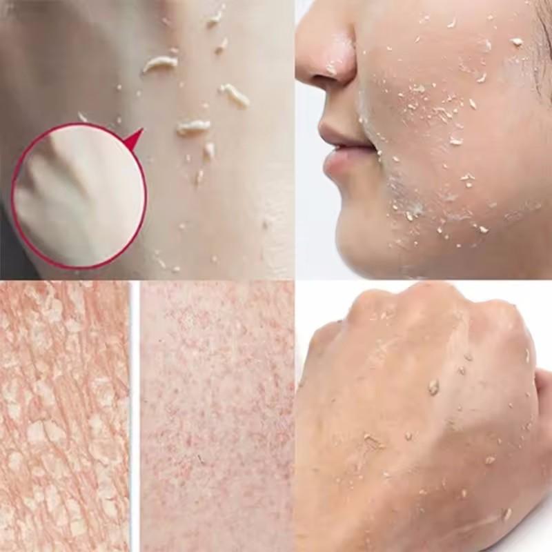 Gel exfoliant Orange pour le v - Ceramide Moisturizer avis et prix