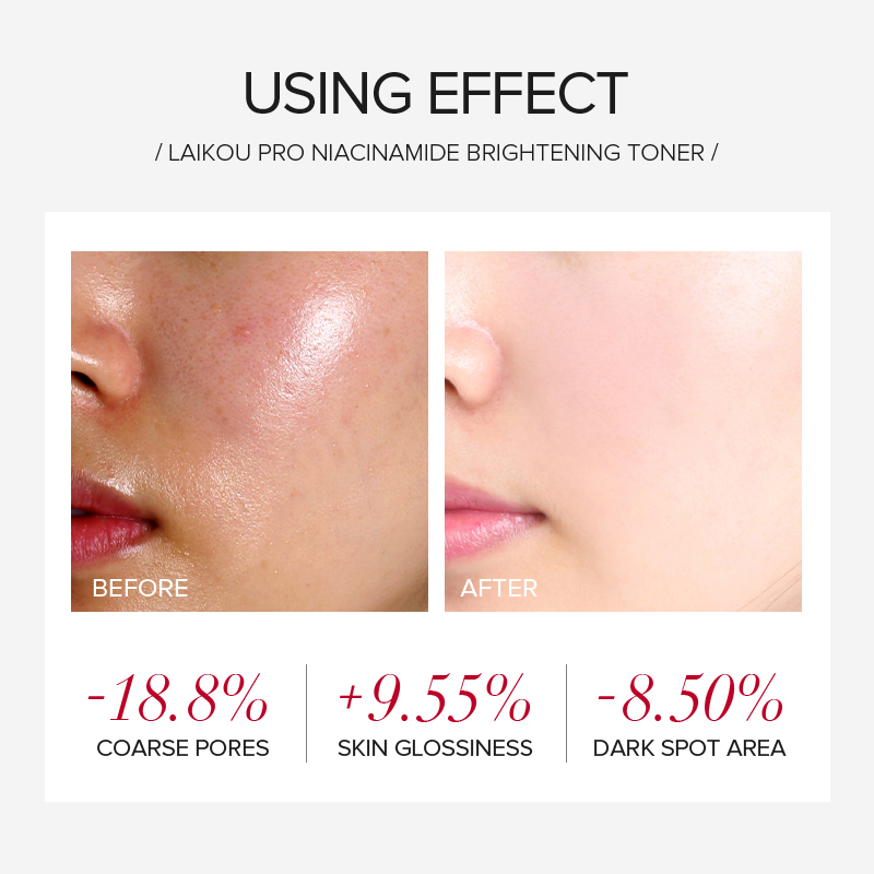 Ensemble de soins éclaircissan - Skincare Niacinamide avis et prix