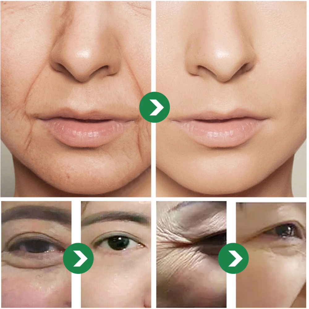 Crème japonaise aux six peptid - Eye Cream Peptide avis et prix