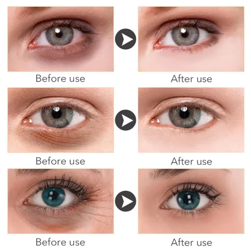 Sérum Huile Contour des Yeux A - Hyaluronic Acid Serum avis et prix